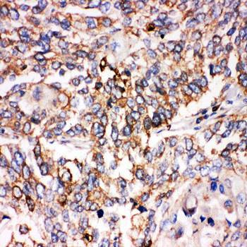 Anti-Smad1 Antibody