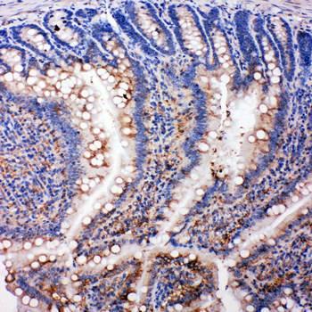 Anti-SMAD5 Antibody