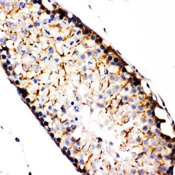 Anti-NAK/TBK1 Antibody