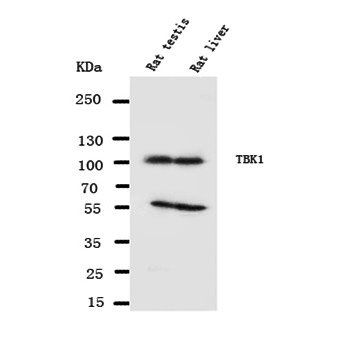 NAK/TBK1 Antibody