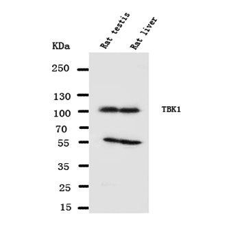 Anti-NAK/TBK1 Antibody