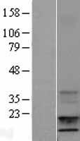 IGF1 Human Over-expression Lysate