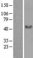 Vitamin D Binding protein (GC) Human Over-expression Lysate