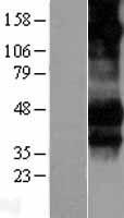 CD16 (FCGR3A) Human Over-expression Lysate
