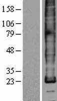 PLP1 Human Over-expression Lysate
