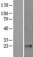 GM2A Human Over-expression Lysate