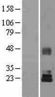 TIMP3 Human Over-expression Lysate