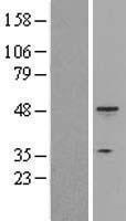 Cytokeratin 18 (KRT18) Human Over-expression Lysate