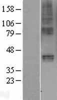 Gastric Inhibitory Polypeptide Receptor (GIPR) Human Over-expression Lysate
