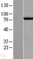 GBE1 Human Over-expression Lysate