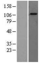 GAA Human Over-expression Lysate
