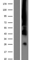Estrogen Receptor 1 (ESR1) Human Over-expression Lysate