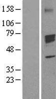 Aromatase (CYP19A1) Human Over-expression Lysate