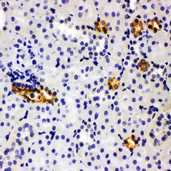 Anti-SLC12A1 Antibody