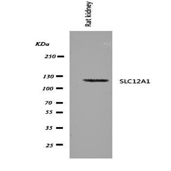 SLC12A1 Antibody