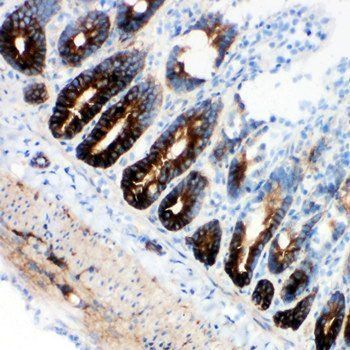 Anti-NKCC1/SLC12A2 Antibody
