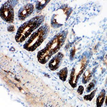 NKCC1/SLC12A2 Antibody