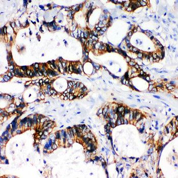 NKCC1/SLC12A2 Antibody