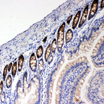 Anti-NKCC1/SLC12A2 Antibody
