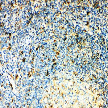 Anti-CCR3 Antibody