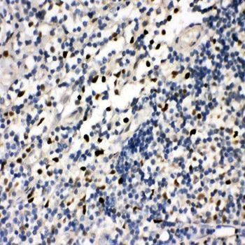 Anti-FLI1 Antibody