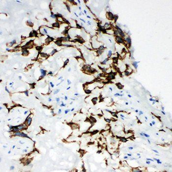 Anti-Hyaluronidase-1 HYAL1 Antibody