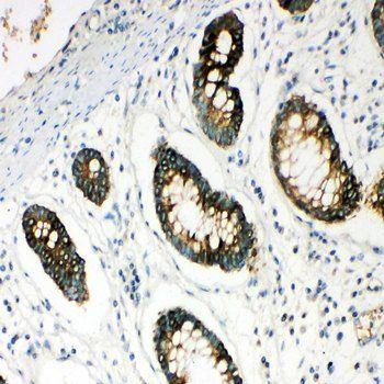 Hyaluronidase-1 HYAL1 Antibody