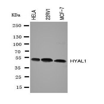 Anti-Hyaluronidase-1 HYAL1 Antibody