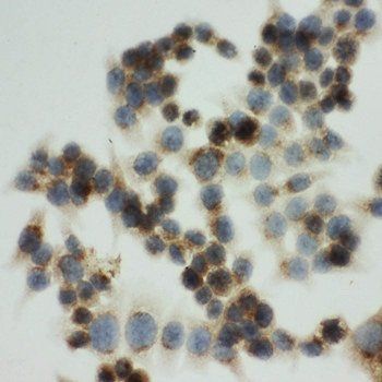 Mannose 6 Phosphate Receptor (Cation independent)/IGF2R Antibody