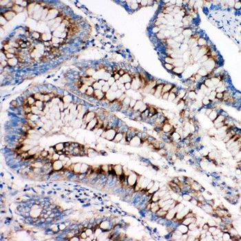 Mannose 6 Phosphate Receptor (Cation independent)/IGF2R Antibody