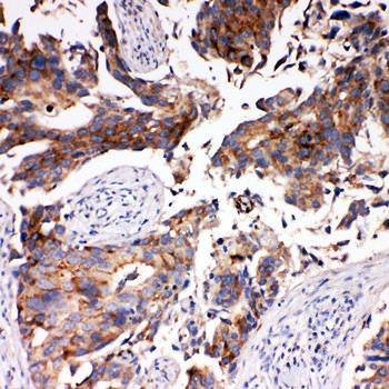 Anti-Monocarboxylate transporter 5 SLC16A4 Antibody