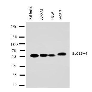 Monocarboxylate transporter 5 SLC16A4 Antibody