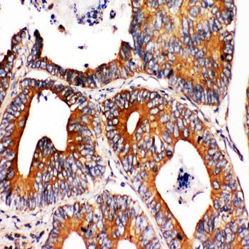 Anti-Integrin alpha 1/ITGA1 Antibody