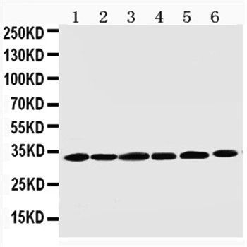 Cyclin D1/CCND1 Rabbit Polyclonal Antibody