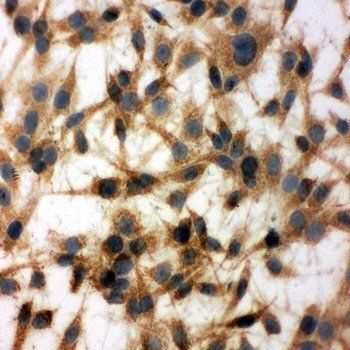 Anti-MTCO1/MT-CO1 Antibody