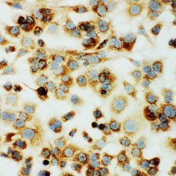 Anti-MTCO1/mt-Co1 Antibody