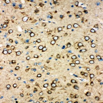 Anti-MTCO1/mt-Co1 Antibody