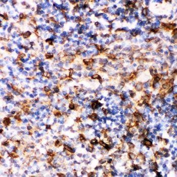 Anti-Caspase-6(P18)/CASP6 Antibody