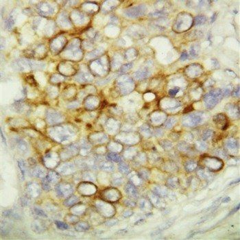Anti-Caspase-6(P18)/CASP6 Antibody