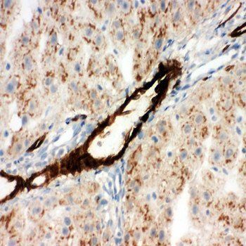 Anti-Adiponectin/ADIPOQ Antibody
