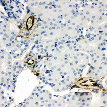 Anti-Adiponectin/ADIPOQ Antibody