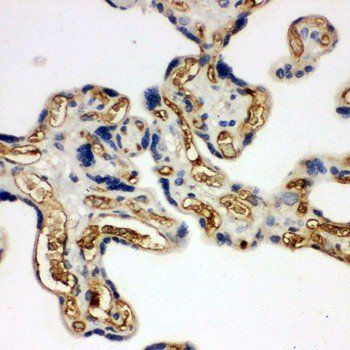 Anti-Adiponectin/ADIPOQ Antibody