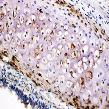 Anti-Collagen II/COL2A1 Antibody