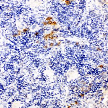 Anti-Leupaxin/LPXN Antibody