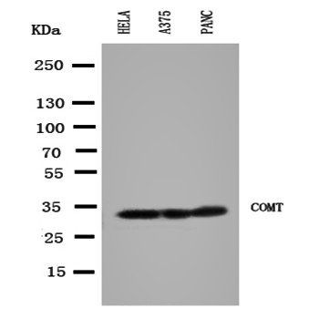 Catechol O-methyltransferase COMT Antibody