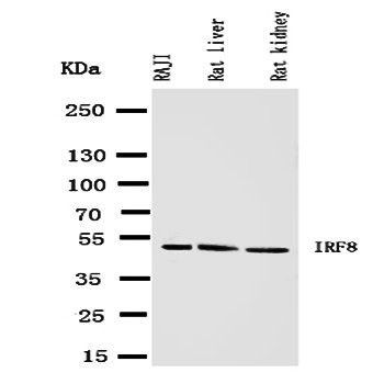 Interferon regulatory factor 8 IRF8 Antibody