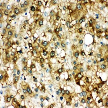 Anti-AACT/SERPINA3 Antibody