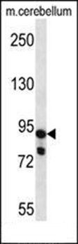 USP45 antibody