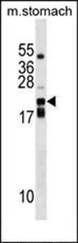CDC42EP2 antibody