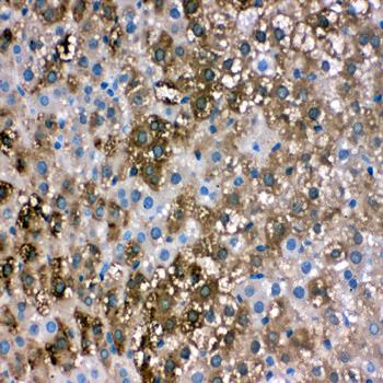 liver FABP/FABP1 Antibody